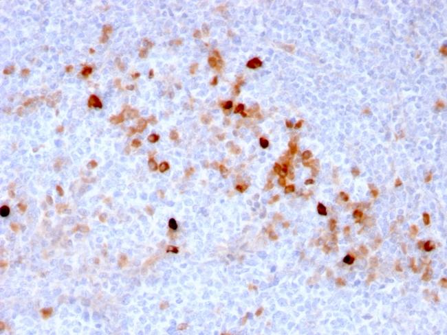 Endoglin/CD105 (Angiogenesis Marker) Antibody in Immunohistochemistry (Paraffin) (IHC (P))