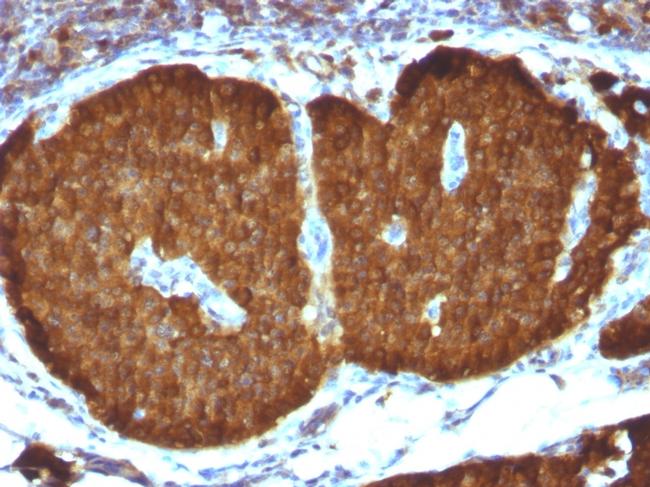 NSE gamma (Neuron Specific Enolase, gamma) Antibody in Immunohistochemistry (Paraffin) (IHC (P))