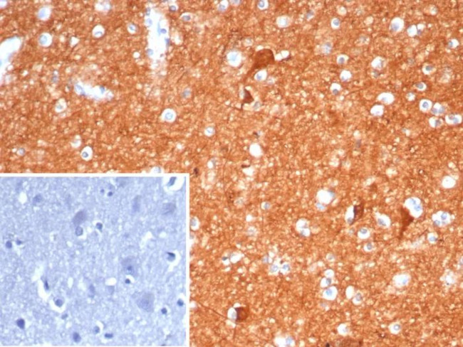 NSE gamma (Neuron Specific Enolase, gamma) (Neuroendocrine Marker) Antibody in Immunohistochemistry (Paraffin) (IHC (P))