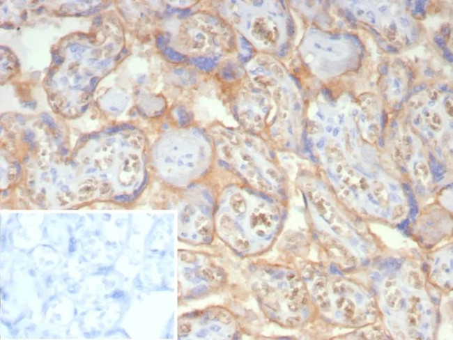 NSE gamma (Neuron Specific Enolase, gamma) (Neuroendocrine Marker) Antibody in Immunohistochemistry (Paraffin) (IHC (P))