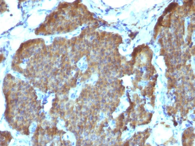 NSE gamma (Neuron Specific Enolase, gamma) (Neuroendocrine Marker) Antibody in Immunohistochemistry (Paraffin) (IHC (P))