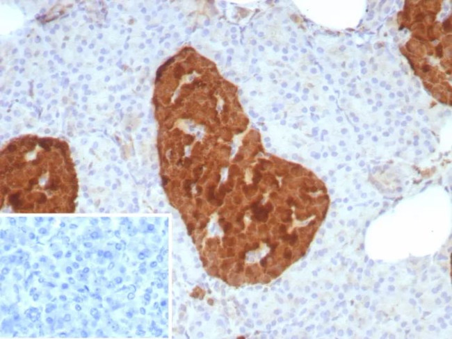 NSE gamma (Neuron Specific Enolase, gamma) (Neuroendocrine Marker) Antibody in Immunohistochemistry (Paraffin) (IHC (P))