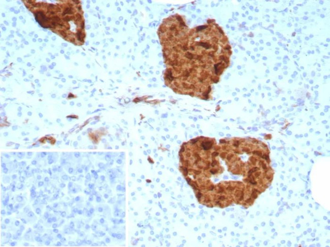 NSE gamma (Neuron Specific Enolase, gamma) (Neuroendocrine Marker) Antibody in Immunohistochemistry (Paraffin) (IHC (P))