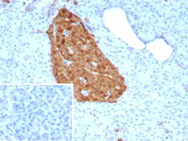 NSE gamma (Neuron Specific Enolase, gamma) (Neuroendocrine Marker) Antibody in Immunohistochemistry (Paraffin) (IHC (P))