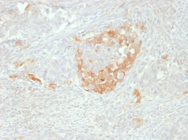 NSE gamma (Neuron Specific Enolase, gamma) Antibody in Immunohistochemistry (Paraffin) (IHC (P))