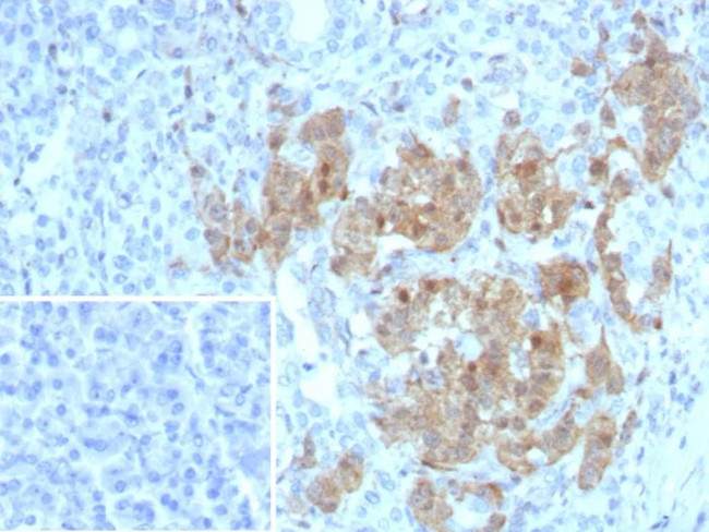 NSE gamma (Neuron Specific Enolase, gamma) (Neuroendocrine Marker) Antibody in Immunohistochemistry (Paraffin) (IHC (P))