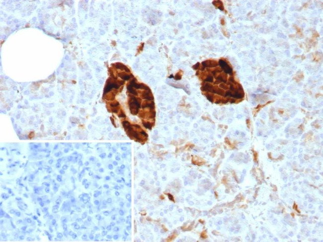 NSE gamma (Neuron Specific Enolase, gamma) (Neuroendocrine Marker) Antibody in Immunohistochemistry (Paraffin) (IHC (P))