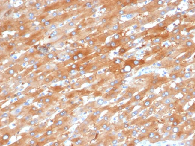 EPH Receptor B4 (EPHB4) Antibody in Immunohistochemistry (Paraffin) (IHC (P))