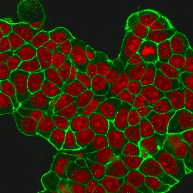 HER-2/c-erbB-2/neu/CD340 Antibody in Immunocytochemistry (ICC/IF)