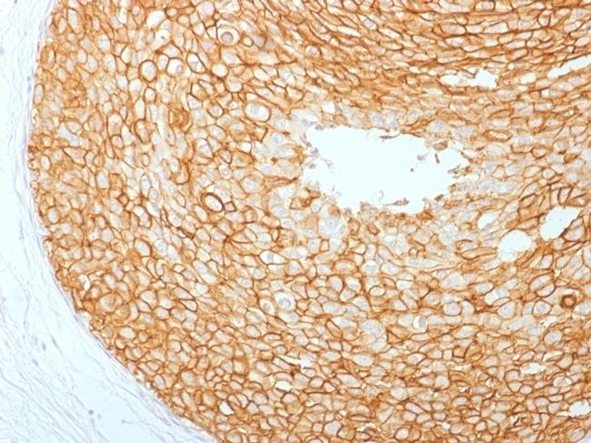 HER-2/c-erbB-2/neu/CD340 Antibody in Immunohistochemistry (Paraffin) (IHC (P))