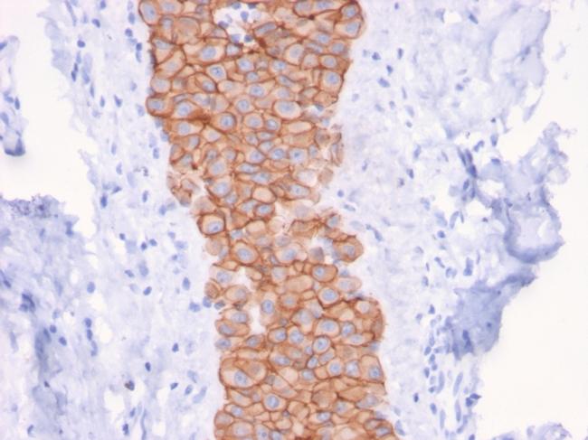 HER-2/c-erbB-2/neu/CD340 Antibody in Immunohistochemistry (Paraffin) (IHC (P))