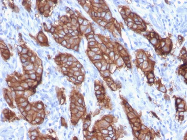 HER-2/c-erbB-2/neu/CD340 Antibody in Immunohistochemistry (Paraffin) (IHC (P))