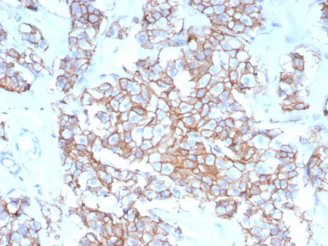 HER-2/c-erbB-2/neu/CD340 Antibody in Immunohistochemistry (Paraffin) (IHC (P))