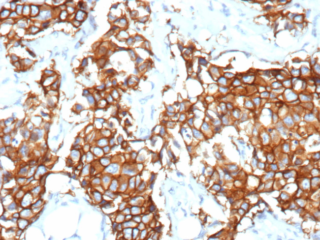 HER-2/c-erbB-2/neu/CD340 Antibody in Immunohistochemistry (Paraffin) (IHC (P))