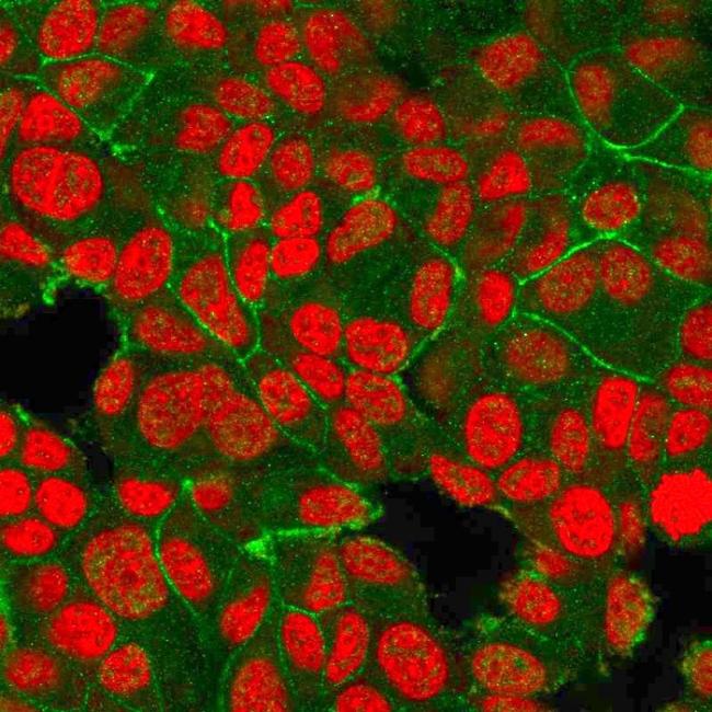 HER-2/c-erbB-2/neu/CD340 Antibody in Immunocytochemistry (ICC/IF)