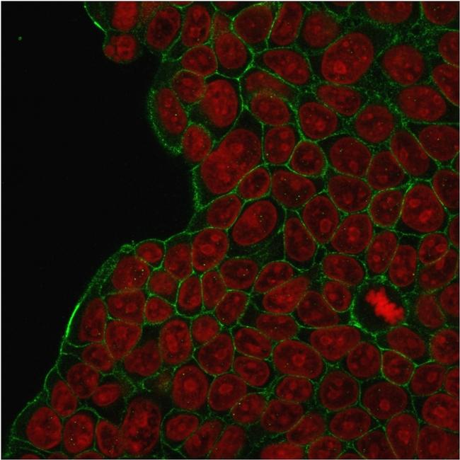 HER-2/c-erbB-2/neu/CD340 Antibody in Immunocytochemistry (ICC/IF)