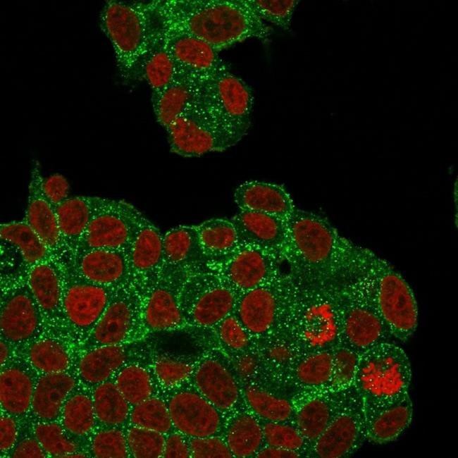 HER-2/c-erbB-2/neu/CD340 Antibody in Immunocytochemistry (ICC/IF)