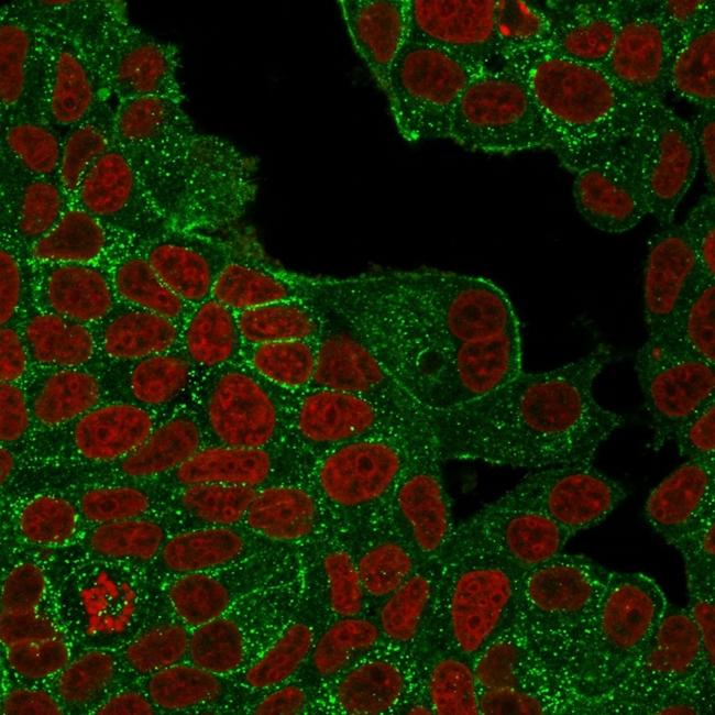 HER-2/c-erbB-2/neu/CD340 Antibody in Immunocytochemistry (ICC/IF)