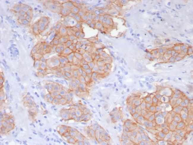 HER-2/c-erbB-2/neu/CD340 Antibody in Immunohistochemistry (Paraffin) (IHC (P))