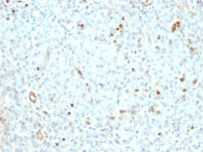 ERCC1/RAD10 (Tumor Progression Marker) Antibody in Immunohistochemistry (Paraffin) (IHC (P))