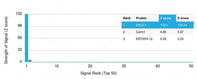 ERCC1/RAD10 (Tumor Progression Marker) Antibody in Peptide array (ARRAY)