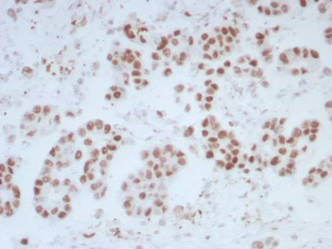 ERCC1/RAD10 (Tumor Progression Marker) Antibody in Immunohistochemistry (Paraffin) (IHC (P))