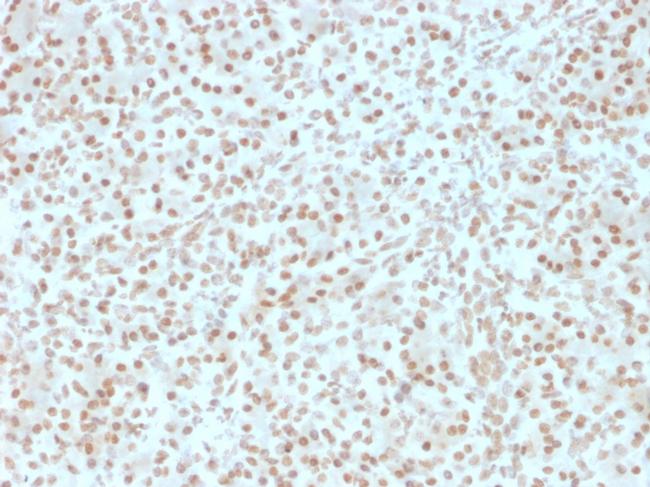 AKT1 Antibody in Immunohistochemistry (Paraffin) (IHC (P))