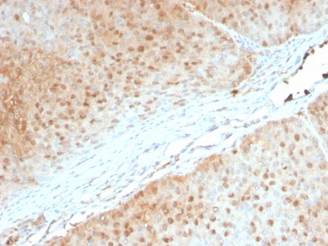 AKT1 Antibody in Immunohistochemistry (Paraffin) (IHC (P))