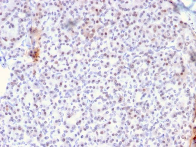 AKT1 Antibody in Immunohistochemistry (Paraffin) (IHC (P))