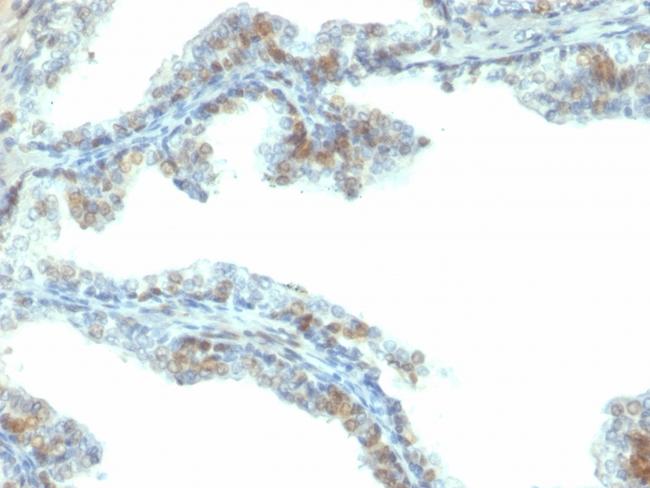 ERG (Vascular Endothelial and Prostate Marker) Antibody in Immunohistochemistry (Paraffin) (IHC (P))