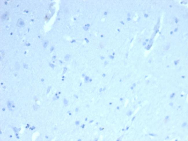 ERG Antibody in Immunohistochemistry (Paraffin) (IHC (P))