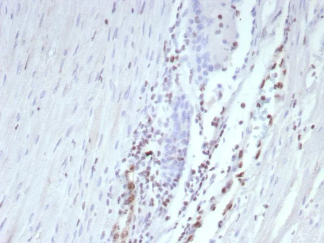 ERG (Vascular Endothelial and Prostate Marker) Antibody in Immunohistochemistry (Paraffin) (IHC (P))