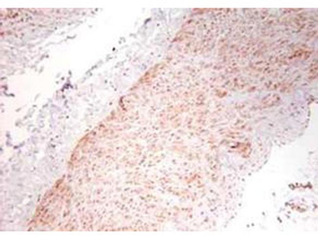 TNF alpha Antibody in Immunohistochemistry (Paraffin) (IHC (P))