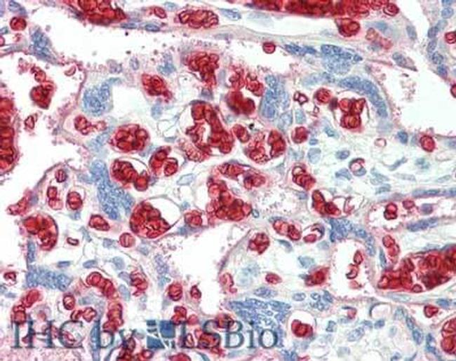 Red Blood Cell Antibody in Immunohistochemistry (Paraffin) (IHC (P))