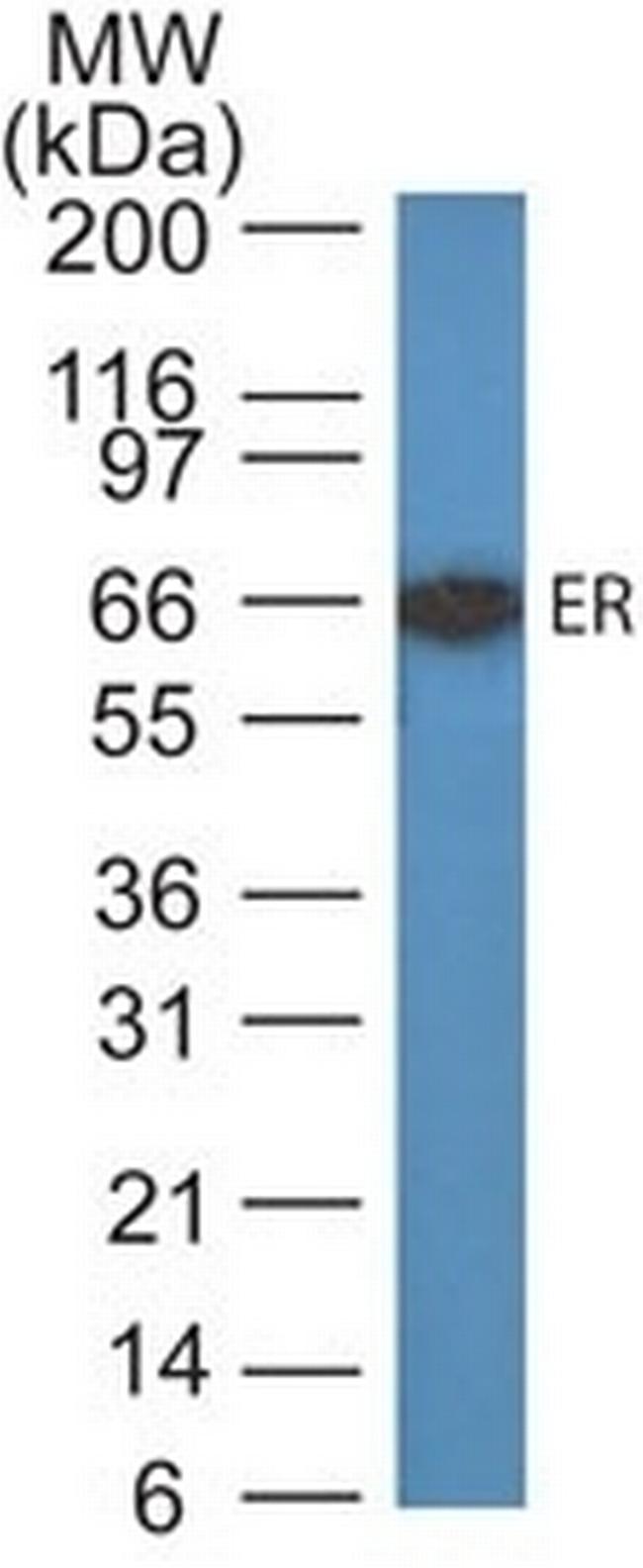 Estrogen Receptor (Marker of Estrogen Dependence) Antibody in Western Blot (WB)