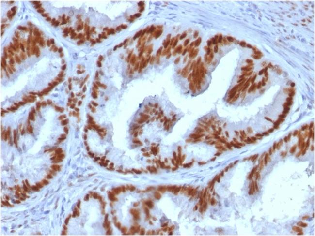 Estrogen Receptor, alpha (Marker of Estrogen Dependence) Antibody in Immunohistochemistry (Paraffin) (IHC (P))