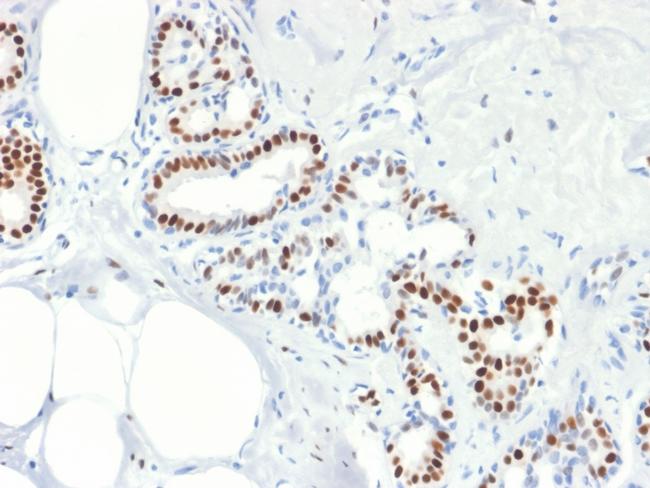 Estrogen Receptor, alpha (Marker of Estrogen Dependence) Antibody in Immunohistochemistry (Paraffin) (IHC (P))