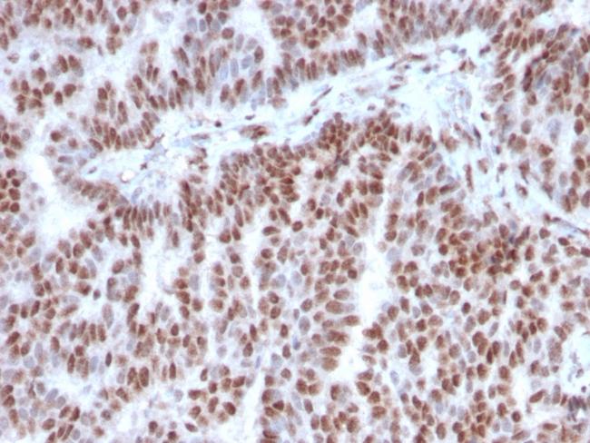 Estrogen Receptor, alpha (Marker of Estrogen Dependence) Antibody in Immunohistochemistry (Paraffin) (IHC (P))