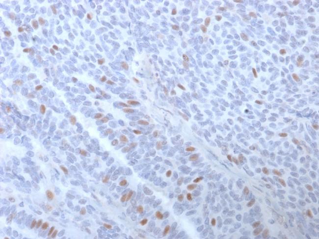 Estrogen Receptor, alpha (Marker of Estrogen Dependence) Antibody in Immunohistochemistry (Paraffin) (IHC (P))