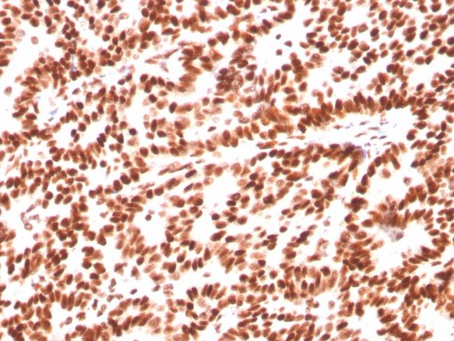 Estrogen Receptor, alpha (Marker of Estrogen Dependence) Antibody in Immunohistochemistry (Paraffin) (IHC (P))