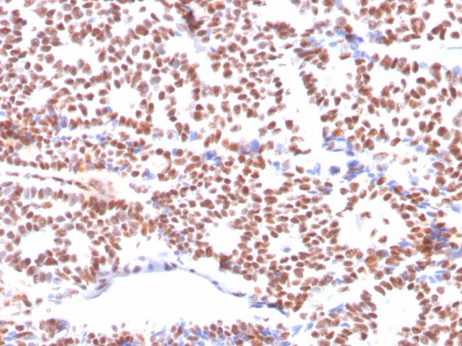 Estrogen Receptor, alpha (Marker of Estrogen Dependence) Antibody in Immunohistochemistry (Paraffin) (IHC (P))