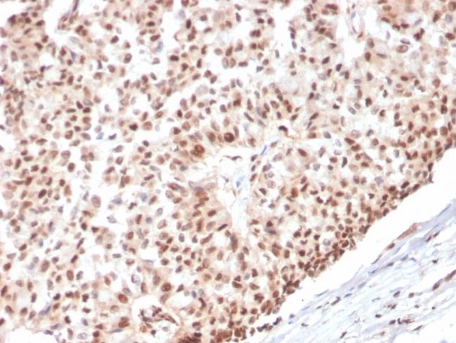 Estrogen Receptor, alpha (Marker of Estrogen Dependence) Antibody in Immunohistochemistry (Paraffin) (IHC (P))