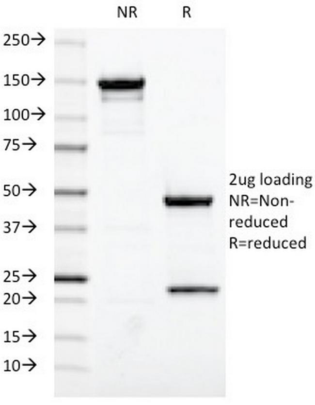 Estrogen Receptor (Marker of Estrogen Dependence) Antibody in SDS-PAGE (SDS-PAGE)