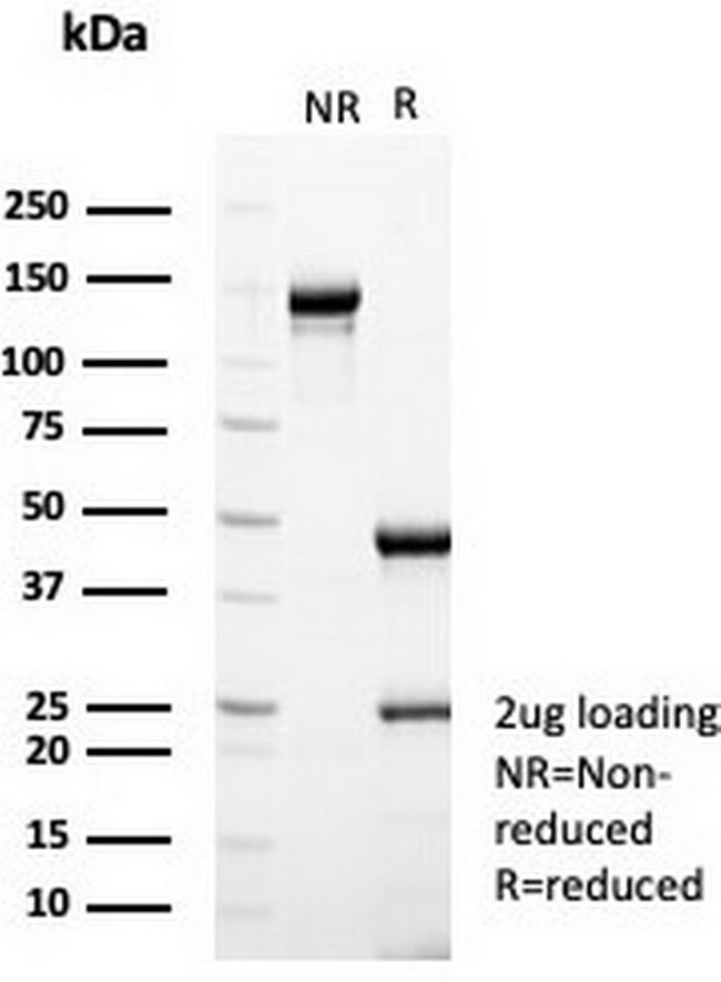 Estrogen Receptor, alpha (Marker of Estrogen Dependence) Antibody in SDS-PAGE (SDS-PAGE)