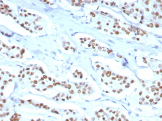 Estrogen Receptor, alpha (Marker of Estrogen Dependence) Antibody in Immunohistochemistry (Paraffin) (IHC (P))