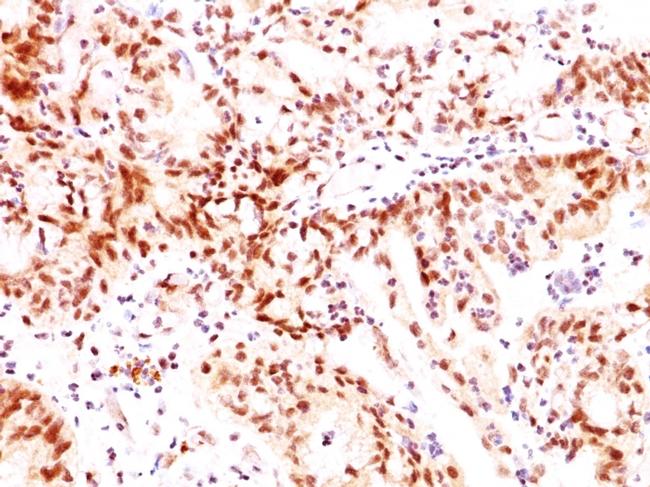 ER-beta-1 (Estrogen Receptor beta-1) Antibody in Immunohistochemistry (Paraffin) (IHC (P))