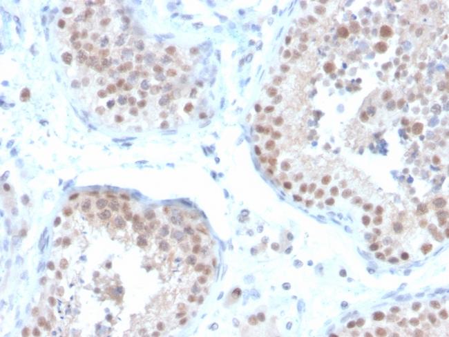 ER-beta (Estrogen Receptor beta-2) Antibody in Immunohistochemistry (Paraffin) (IHC (P))