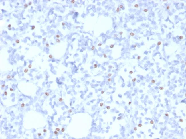 ER-beta (Estrogen Receptor beta-5) Antibody in Immunohistochemistry (Paraffin) (IHC (P))