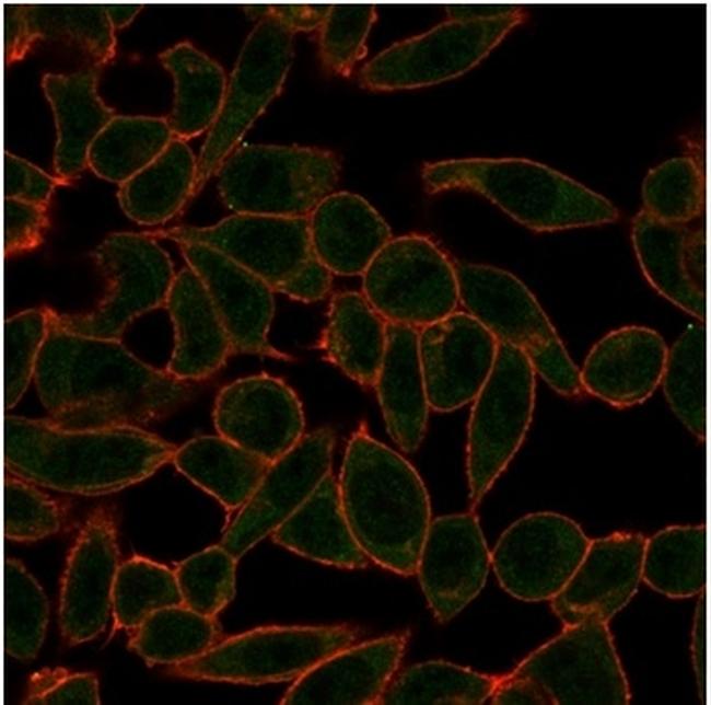 ETS2 (Transcription Factor) Antibody in Immunocytochemistry (ICC/IF)