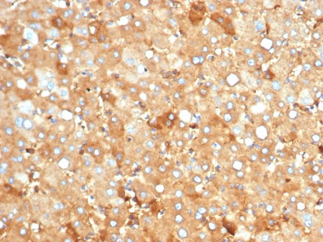 Albumin (Transport Protein) Antibody in Immunohistochemistry (Paraffin) (IHC (P))